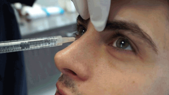 کوچک کردن بینی با تزریق آنزیم | عوارض، مزایا و کاربرد