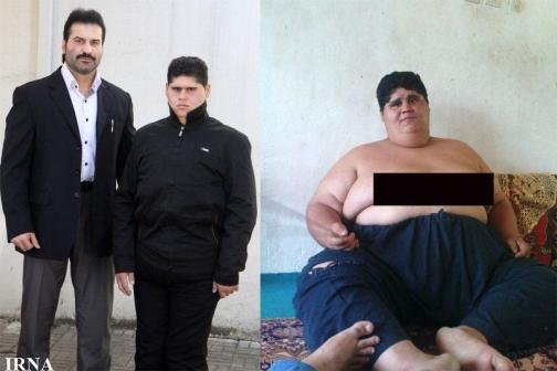 پسری که در ۹ ماه ۱۰۵ کیلو کم کرد+عکس