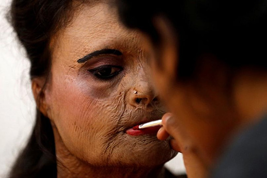 فشن شوی قربانیان اسید پاشی در هندوستان