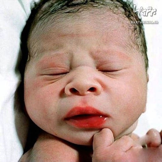 تصاویر جالب از نوزادان تازه متولد شده