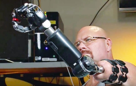 عکس: پیشرفته ترین دست مصنوعی جهان