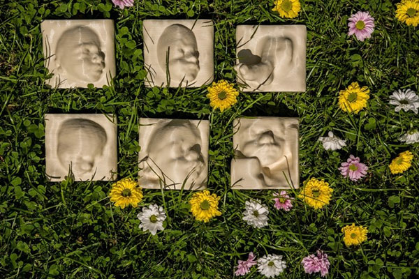 مادران نابینا تصویر سونوگرافی جنین را «ببینند»