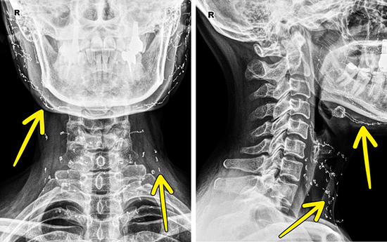اشعه ایکس بهتر از کتاب‌های آناتومی عمل می‌کند!