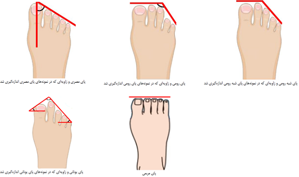 پایِ ایرانیان چه شکلی است؟