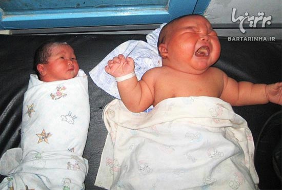 سنگين ترين نوزاد جهان 28 کیلو شد! + عکس