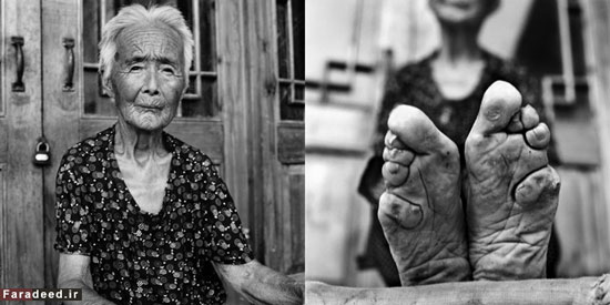 بازماندگان زنان پا کوچک در چین +عکس