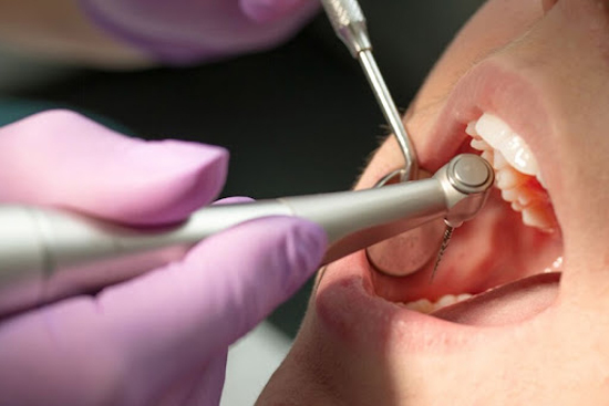 بهترین متخصص عصب کشی دندان کیست؟