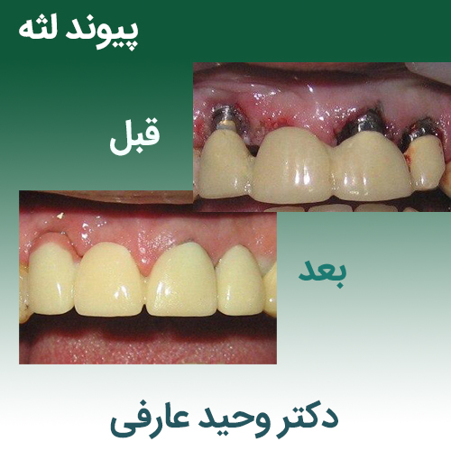 متخصص بیماری‌های لثه و دهان - دکتر وحید عارفی
