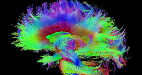 دانشمندان منشا خودآگاهی در مغز را یافتند!