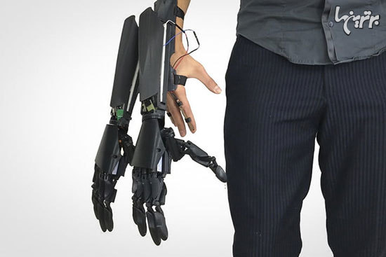 اندام‌های روباتیک که شما را یک سروگردن بالاتر از بقیه قرار می‌دهد