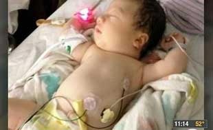 نوزادی که خون در بدنش جریان ندارد +عکس