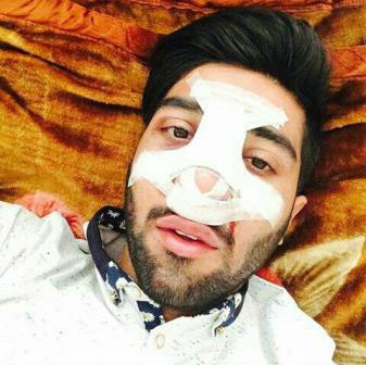 عکس: بینی شکسته بازیکن استقلال