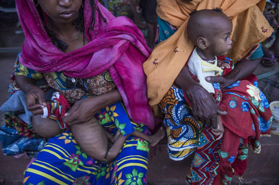 تصاویری دردناک از کودکان گرسنه آفریقا