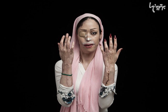 یک ایرانی برنده جایزه عکاسی سونی (18+)