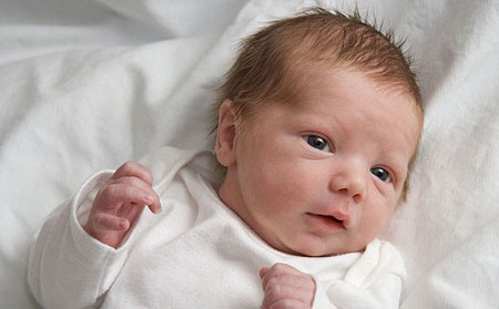 پوسته ریزی سر نوزاد، درمان دارد؟