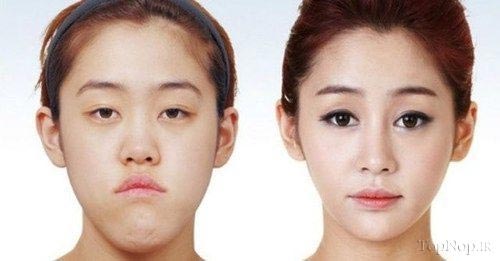 زیبارویان جراحی شده در کره جنوبی +عکس