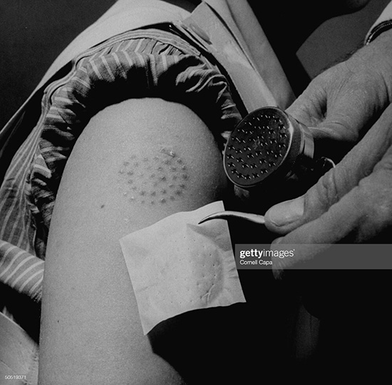 ماندگارترین تصاویر طرح واکسیناسیون در تاریخ