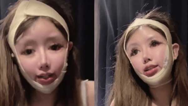 دختر چینی ۱۰۰عمل جراحی زیبایی انجام داد!