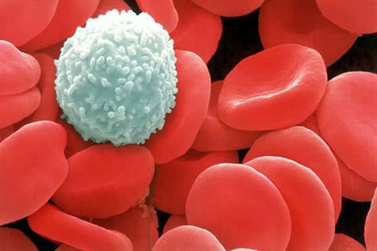 تشخیص زودهنگام و ارزان سرطان خون