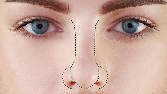 فرم‌دهی بینی بدون جراحی و هرآنچه باید بدانید