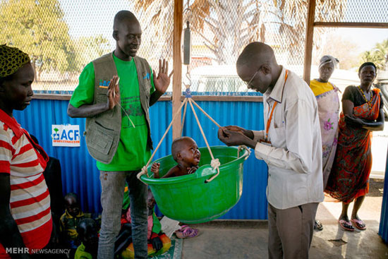 سوء تغذیه شدید در سودان جنوبی +عکس