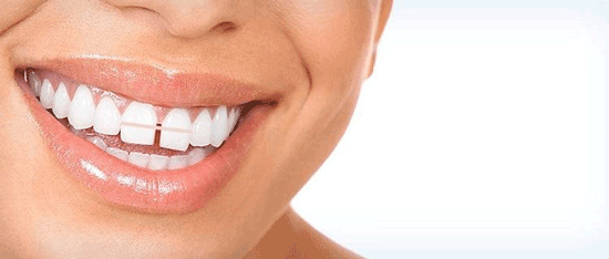 بستن فاصله بین دندان ها با 10 روش مختلف