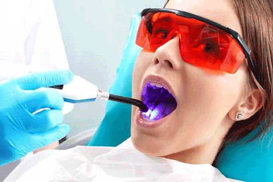 دندانپزشکی با لیزر چه مزایایی دارد؟