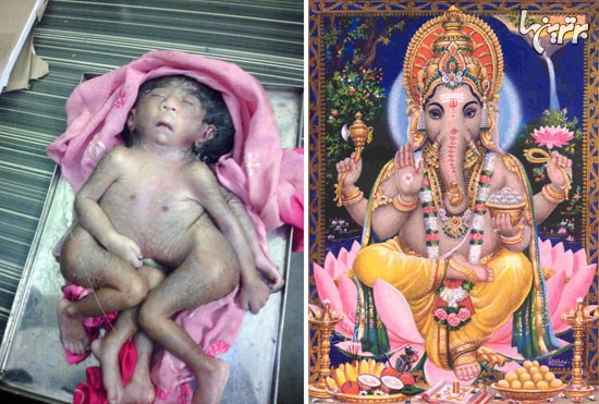 نوزادِ انسان چهارپا، خدای جدید هندی‌ها