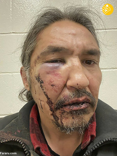 ضرب و شتم رهبر بومیان کانادا توسط پلیس