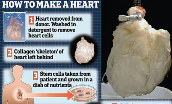 ساختن یک قلب کامل با استفاده از سلول‌های بنیادی