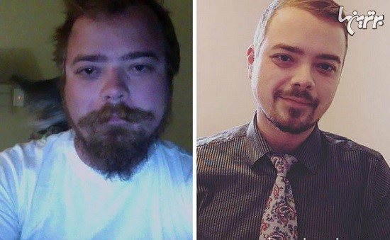 تصاویر قبل و بعد از ترک مشروبات الکلی