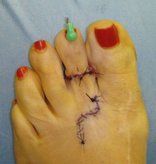 عمل زیبایی انگشتان پای خانم ها! +عکس