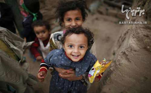 گرسنگی یمن را به سومالی تبدیل کرد+عکس