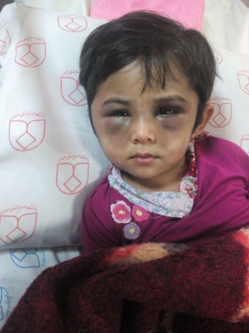 آزار کودک افغانستانی در خمینی شهر