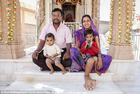 بیماری عجیب پسر 4 ساله هندی +عکس