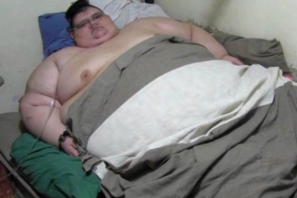 چاق ترین مرد جهان، فردی که 589 کیلوگرم وزن دارد